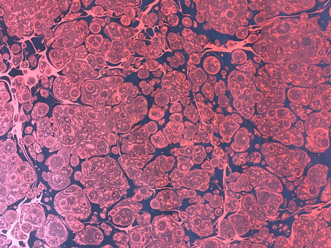 Marmurinis popierius || Stormont || Marbled paper